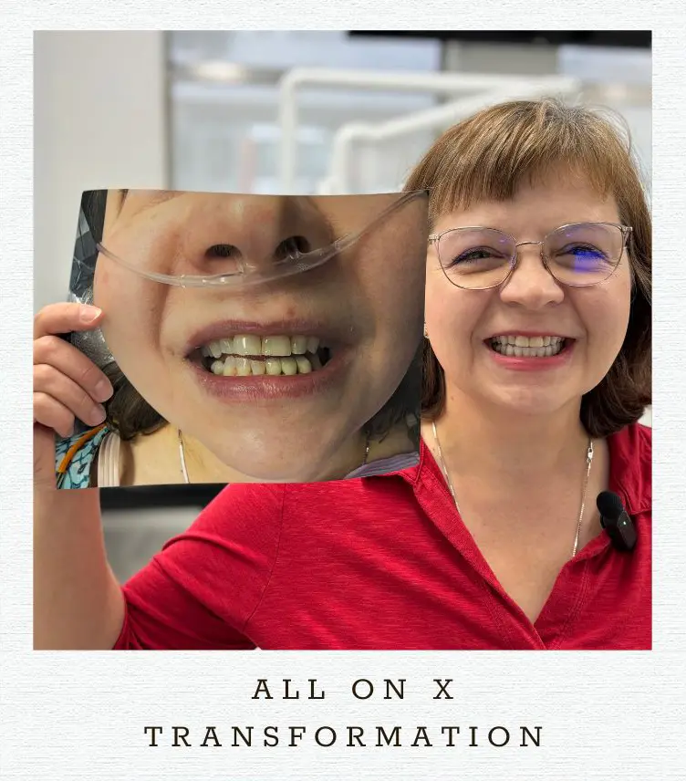 View our Smile Gallery showing Before & After Results