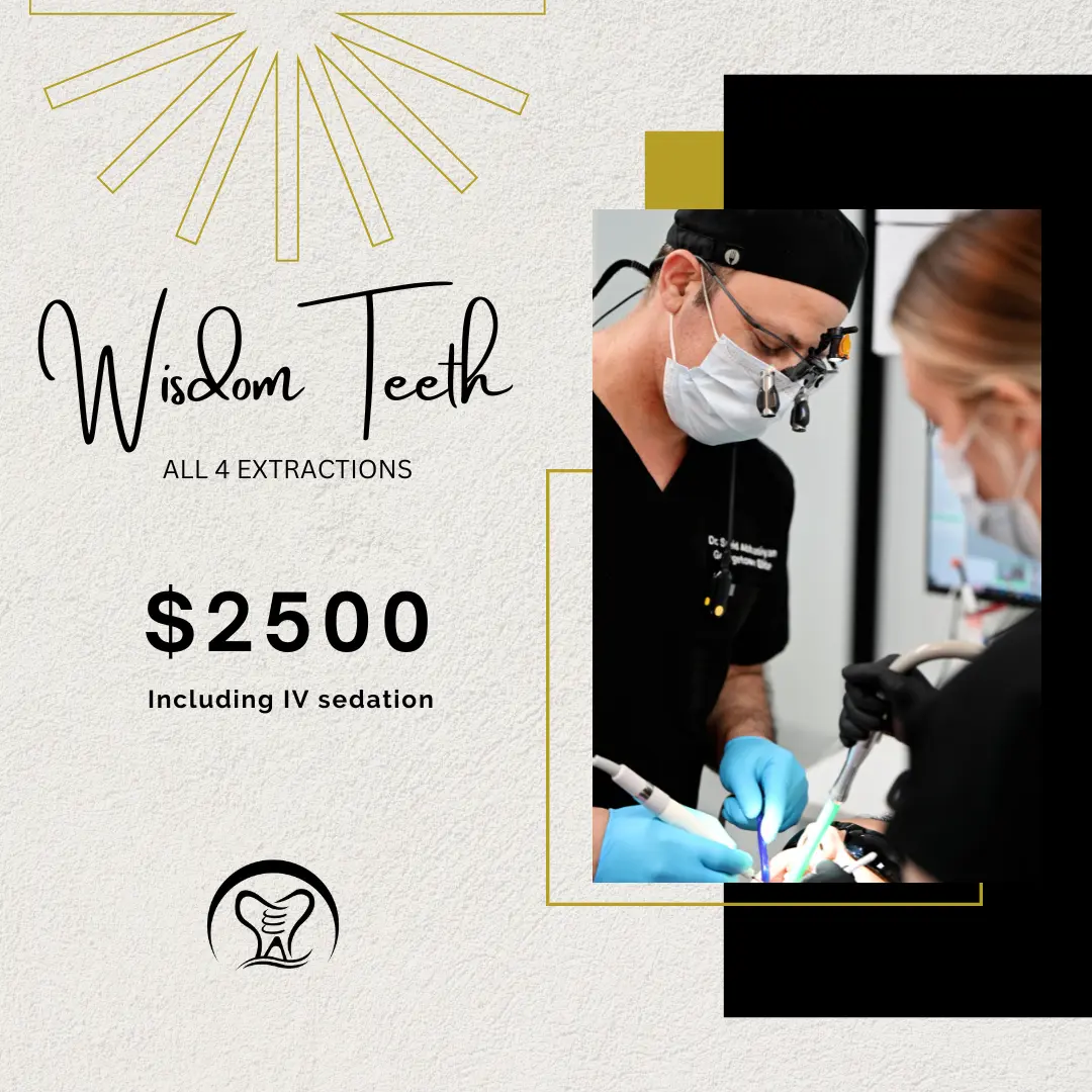 Wisdom teeth extraction procedure with dentist performing all four extractions, priced at $2500 including IV sedation